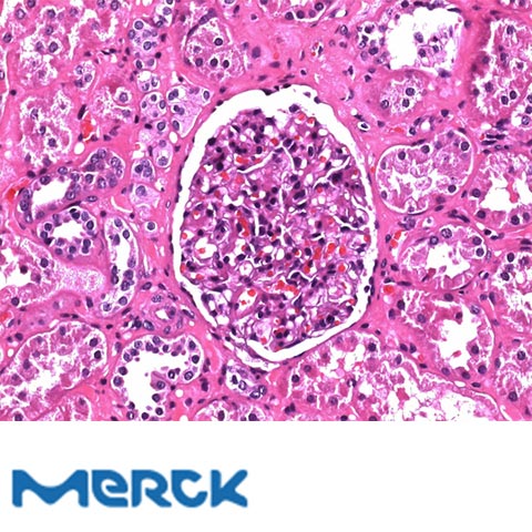 Hematoxylin Solution For Microscopy Merck