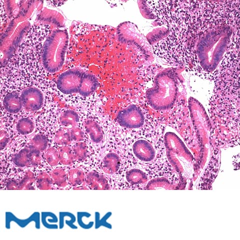 Eosine Y- Solution %0.5 Aqueous For Microscopy Merck