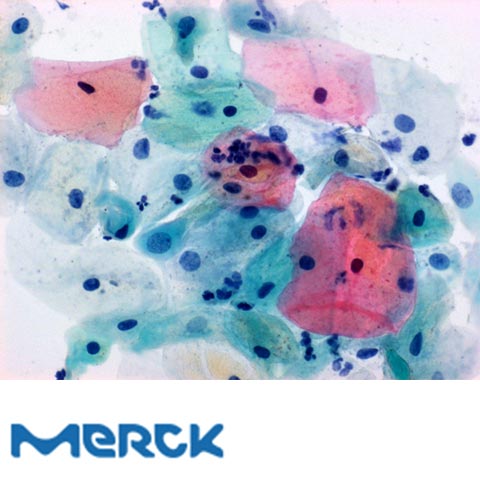 Papanicolaous Solution 1a Harris Hematoxylin Solution For Cytological Cancer And Cycle Diagnosis Merck
